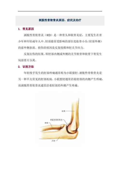 剥脱性骨软骨炎原因、症状及治疗