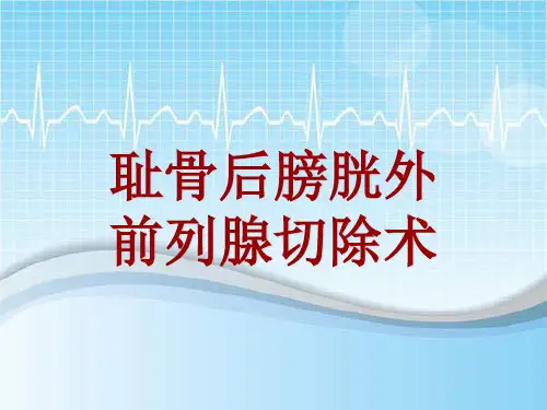 外科手术教学资料：耻骨后膀胱外前列腺切除术讲解模板