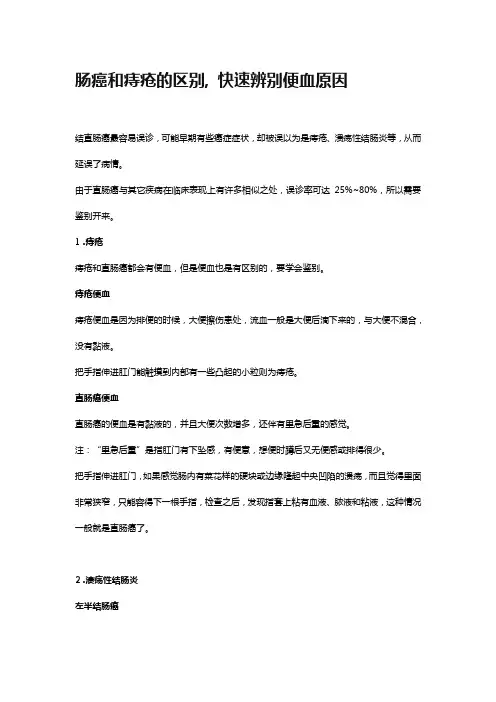 简单辨别肠癌和痔疮的区别