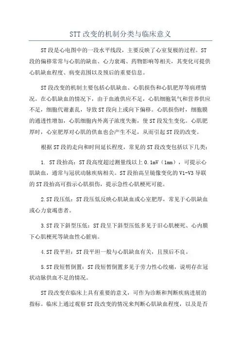 STT改变的机制分类与临床意义