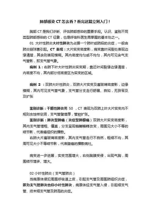 肺部感染CT怎么看？看完这篇立刻入门！