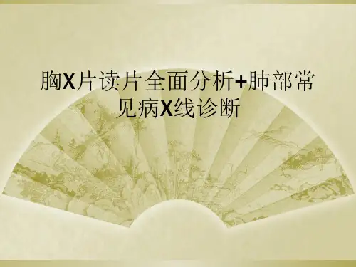 胸X片读片全面分析+肺部常见病X线诊断