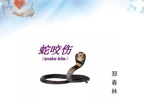 蛇咬伤