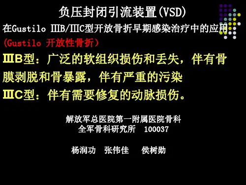 骨科 负压封闭引流装置(VSD)