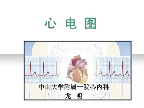 心电图