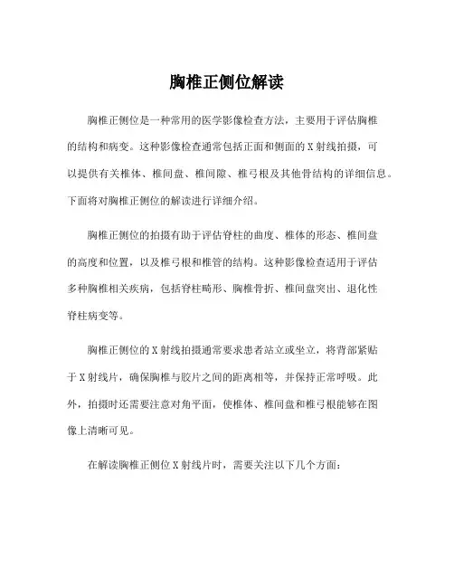 胸椎正侧位解读