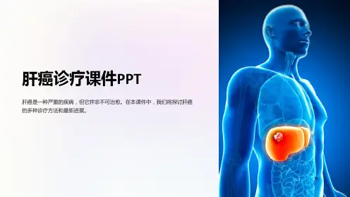 “肝癌诊疗课件PPT”