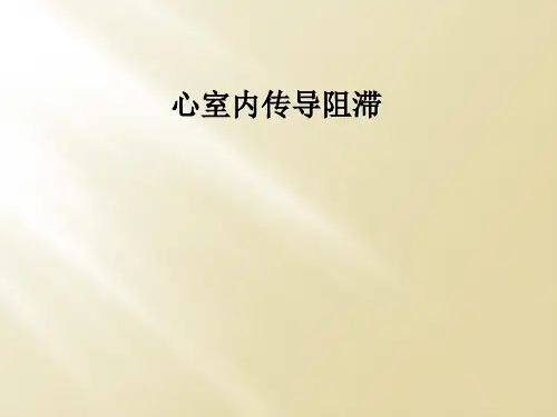 心室内传导阻滞