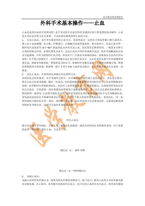 外科手术基本操作——止血