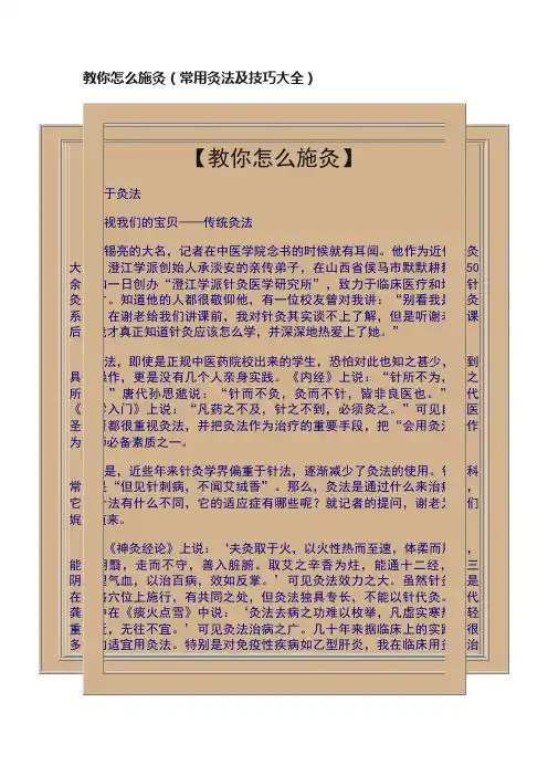 教你怎么施灸（常用灸法及技巧大全）