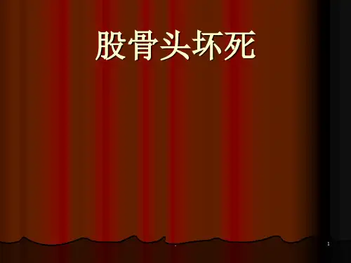 (医学课件)股骨头坏死ppt演示课件
