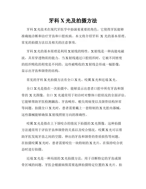 牙科X光及拍摄方法
