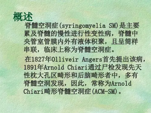 脊髓空洞症-教学课件