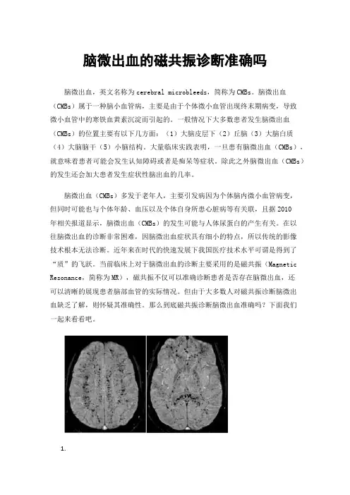 脑微出血的磁共振诊断准确吗