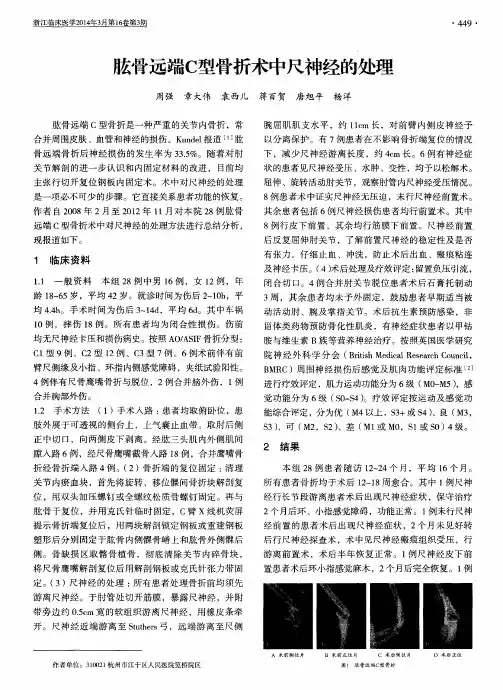 肱骨远端C型骨折术中尺神经的处理
