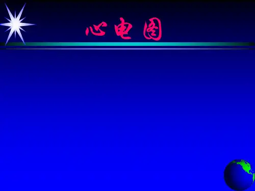 心肌梗死讲解