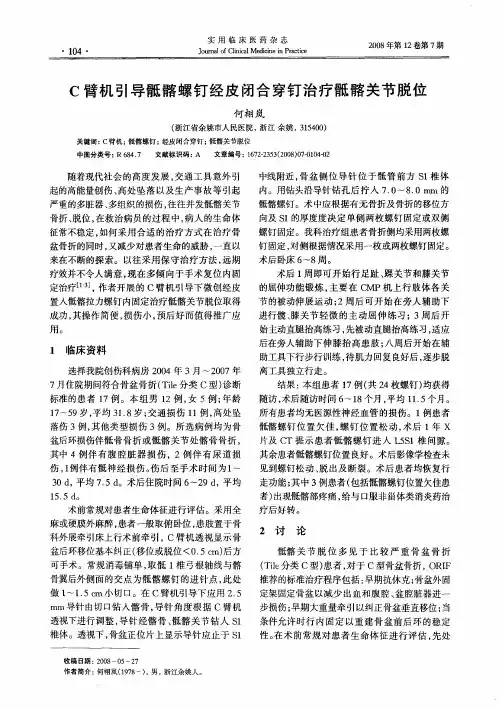 C臂机引导骶髂螺钉经皮闭合穿钉治疗骶髂关节脱位