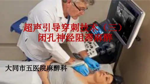 超声引导闭孔神经阻滞麻醉