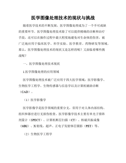 医学图像处理技术的现状与挑战