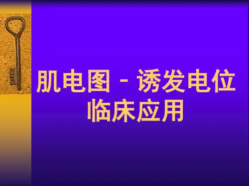肌电图临床应用