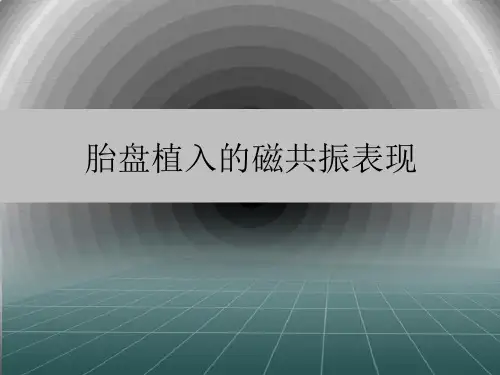 胎盘植入的MRI表现PPT