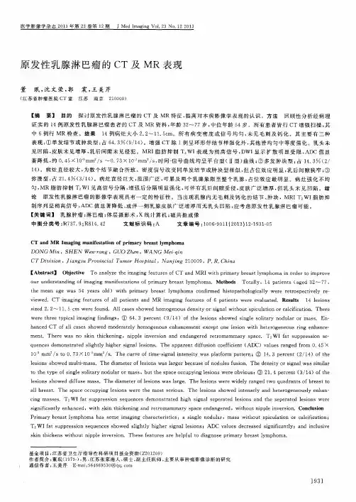原发性乳腺淋巴瘤的CT及MR表现