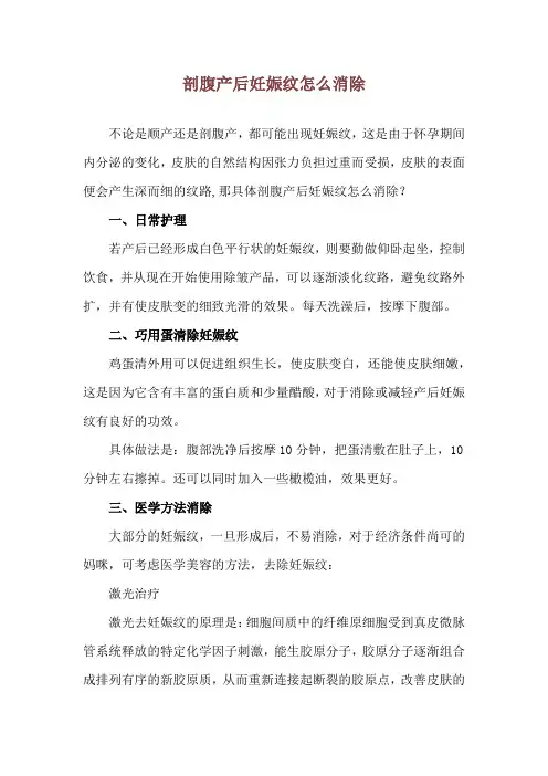 剖腹产后妊娠纹怎么消除