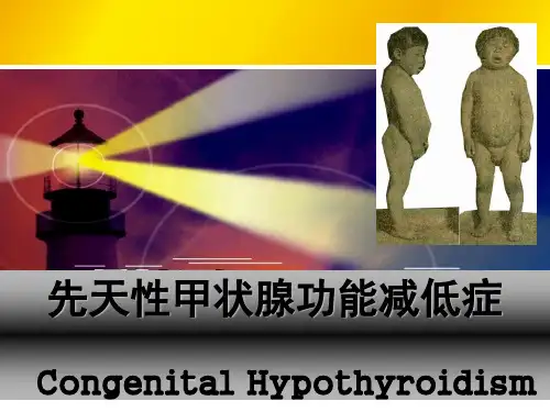 先天性甲状腺功能减退