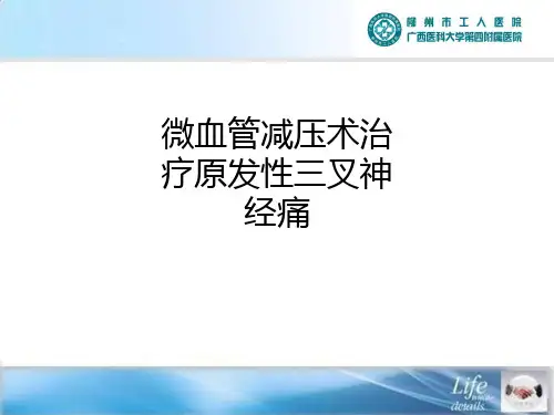 微血管减压术治疗原发性三叉神经痛ppt课件