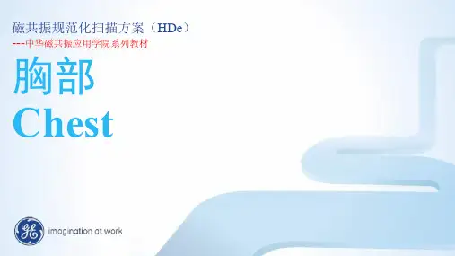 GE_1.5T_MR_胸部规范化扫描方案