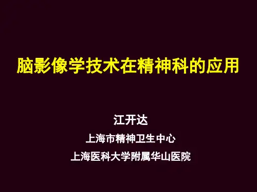 脑影像学技术在精神科的应用