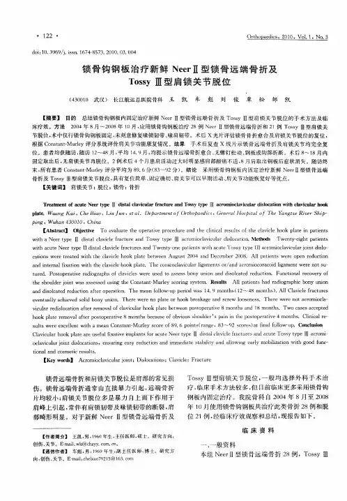 锁骨钩钢板治疗新鲜NeerⅡ型锁骨远端骨折及TossyⅢ型肩锁关节脱位