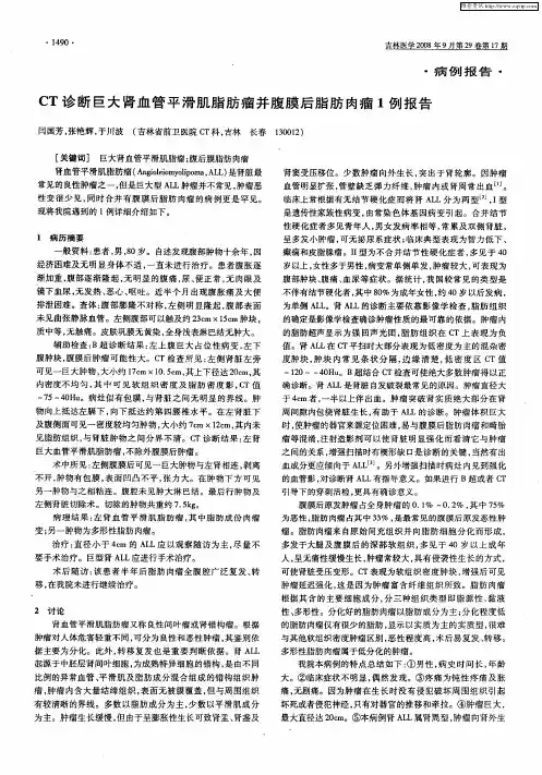 CT诊断巨大肾血管平滑肌脂肪瘤并腹膜后脂肪肉瘤1例报告