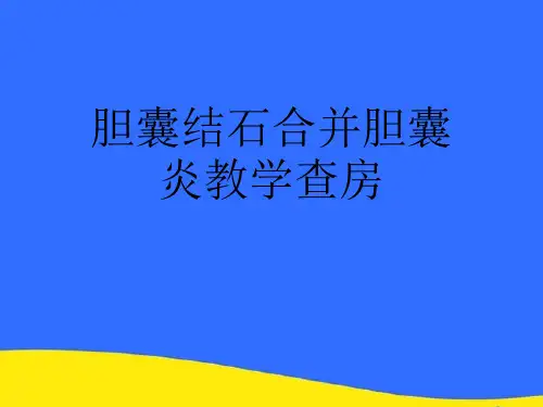 【优选】胆囊结石合并胆囊炎教学查房PPT资料