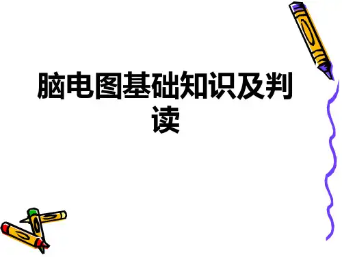 脑电图基础知识及判读