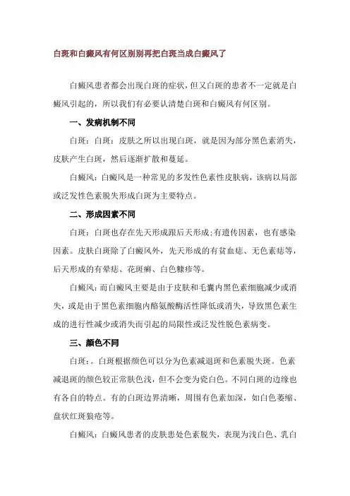 白斑和白癜风有何区别 别再把白斑当成白癜风了