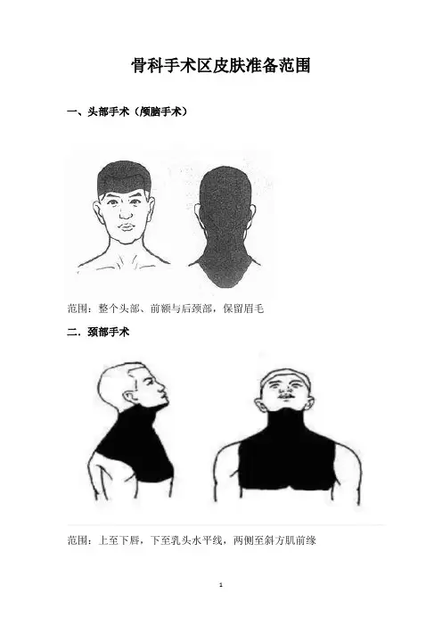 骨科手术区皮肤准备范围