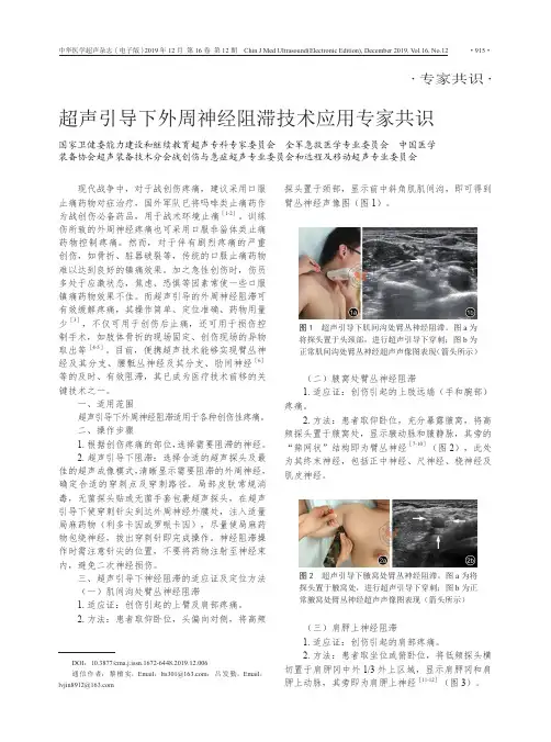 超声引导下外周神经阻滞技术应用专家共识