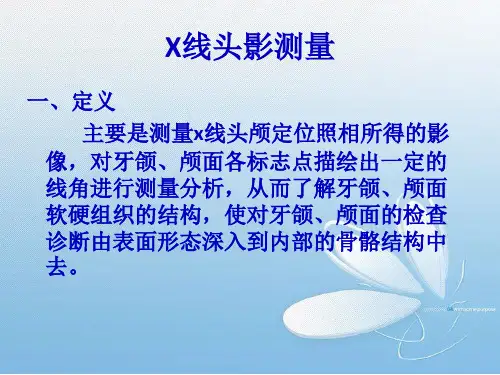 头影测量教案