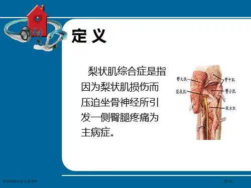 梨状肌综合征专家讲座