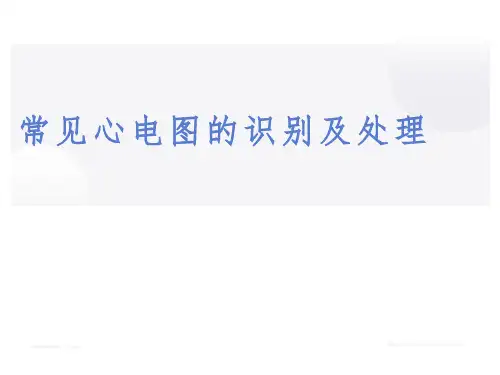 常见心电图的识别及处理