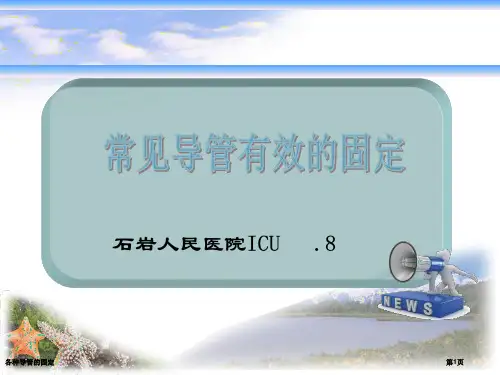 各种导管的固定