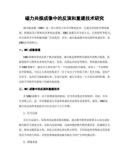 磁力共振成像中的反演和重建技术研究
