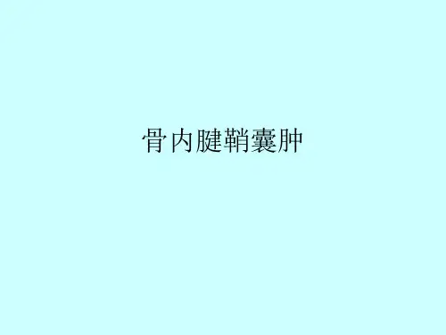 骨内腱鞘囊肿