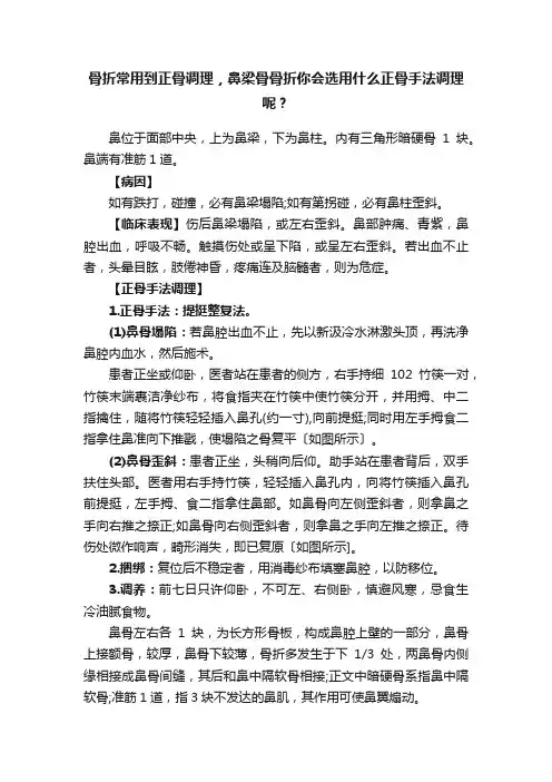 骨折常用到正骨调理，鼻梁骨骨折你会选用什么正骨手法调理呢？