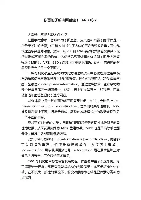 你真的了解曲面重建（CPR）吗？