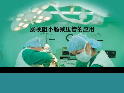 肠梗阻小肠减压管的应用