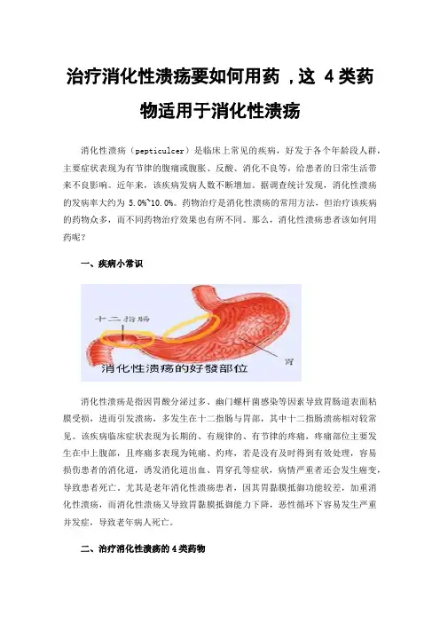 治疗消化性溃疡要如何用药,这4类药物适用于消化性溃疡