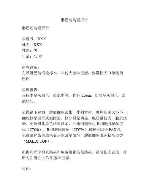 淋巴瘤病理报告