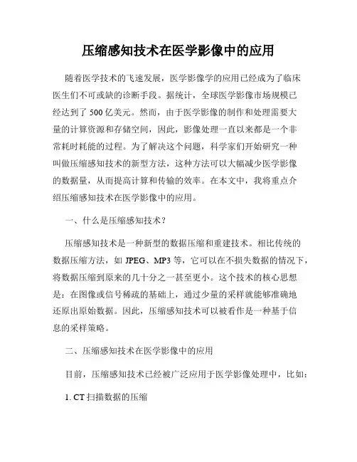 压缩感知技术在医学影像中的应用
